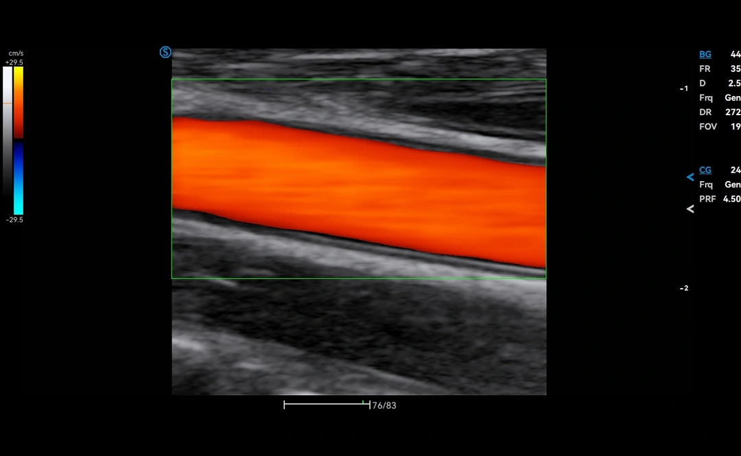 Miniatura 2 (A50)